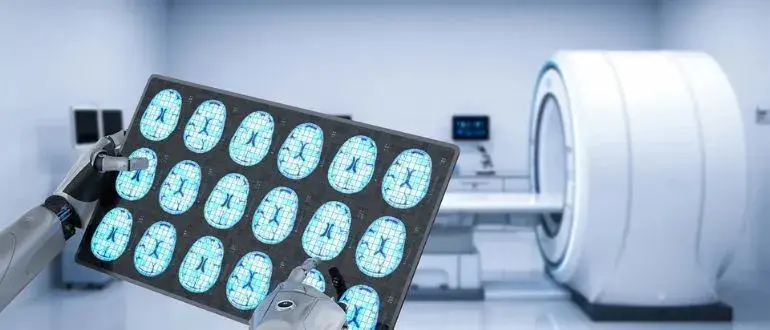 Will AI Replace Radiologists